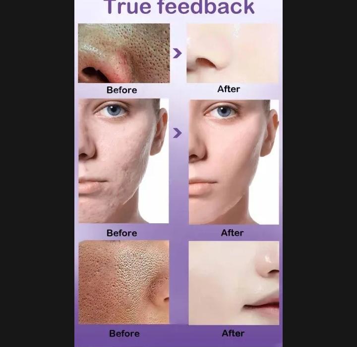 Strengthening & Hydrating Serum for Skin Barrier Repair and Moisture Retention