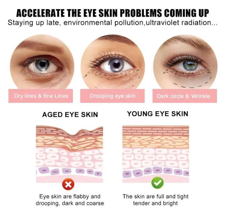Anti Dark Circle Eye Cream – Brightening & Hydrating Under Eye